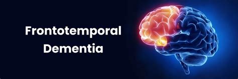 Quais são os sintomas da demência frontotemporal?