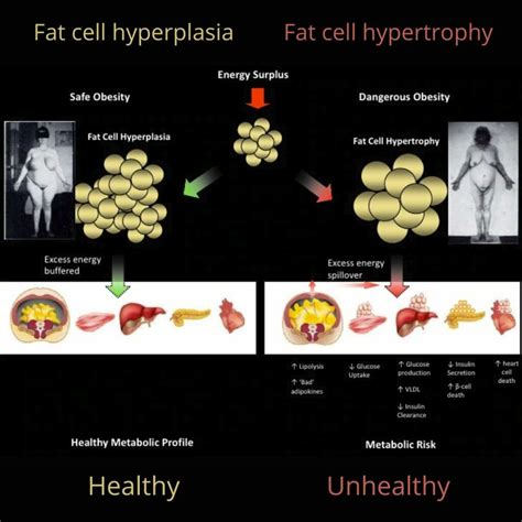 Fat Loss 103: The Relevance of Size and Number of Fat Cells ...