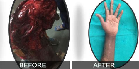 Aggarwal Hospital-Our Treatment History