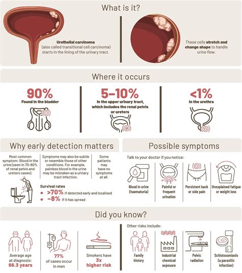 Urothelial Carcinoma: Symptoms, Risks & Early Detection | Parkway Cancer Centre Singapore