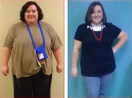 Gastric Bypass Surgery In Puerto Rico, Gastric Bypass Surgery Surgeon ...