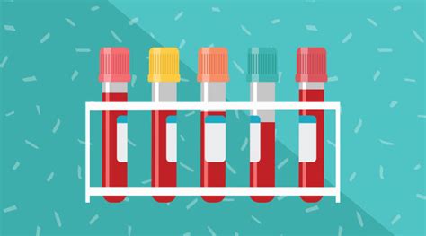 Image result for Fetal Bleed Screen Kit Parallel Testing