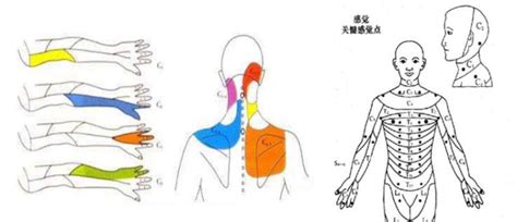 单侧脑瘫儿童的现代上肢康复(上) - 陕西卓恩康复中心
