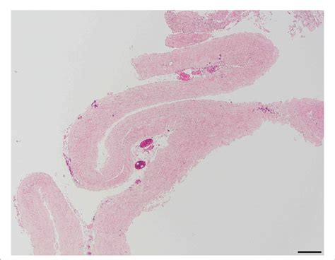 Image result for How to Add Scale Bar On Micrograph