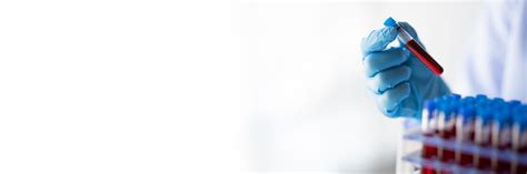 Haematology, Haemato-Oncology & Bone Marrow Transplantation (BMT) | Sir ...