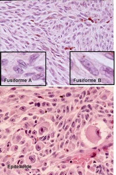 Articulo_Oftalmologia_18520