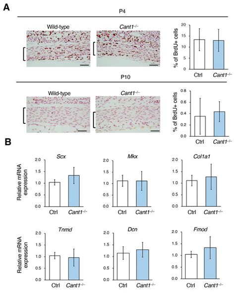 CANT1 Is Involved in Collagen Fibrogenesis in Tendons by Regulating the ...