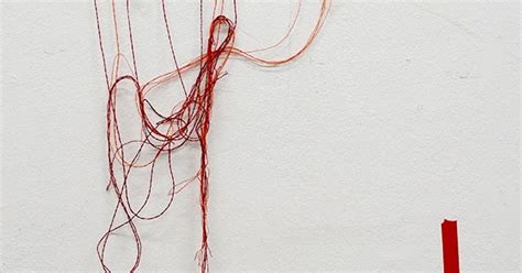 Image result for String ENT