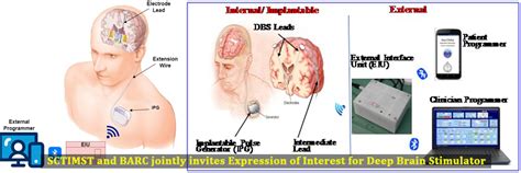 Sree Chitra Tirunal Institute for Medical Sciences and Technology ...