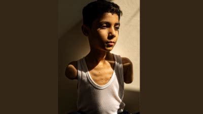 'How will I hug you?': Haunting image of Palestinian boy maimed in Gaza ...