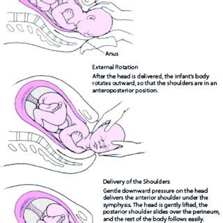 Image result for Vaginal Delivery Tips