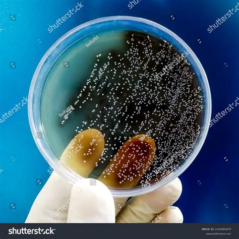 Petri Dish Bacteria Identification