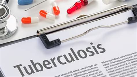 121 people die of TB in Mizoram since January, health department ...