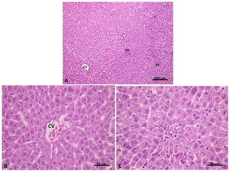Hepatoprotective Role of Carvedilol against Ischemic Hepatitis ...