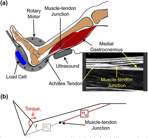 Achilles Reflex Diagram