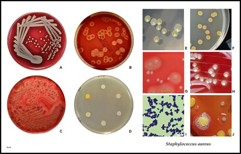Blood Agar Staphylococcus Aureus Bacteria Staphylococcus Aureus, 3D