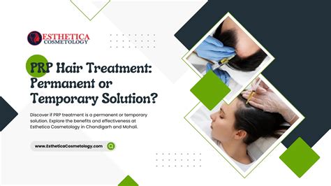 PRP Hair Treatment: Permanent or Temporary Solution?