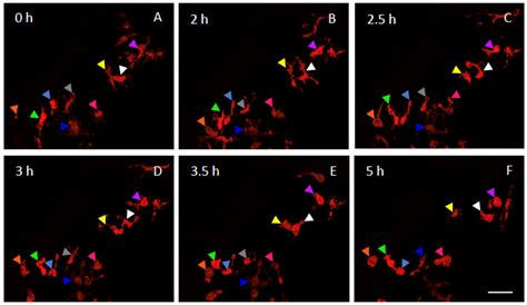 Microglia Remodelling and Neuroinflammation Parallel Neuronal ...