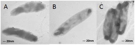 Transmission Electron Microscopy of XDR Mycobacterium tuberculosis ...