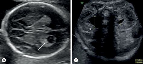 Fetal Medicine - Clinical Tree