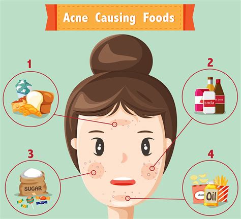 6 Foods that Cause Acne – DrFormulas