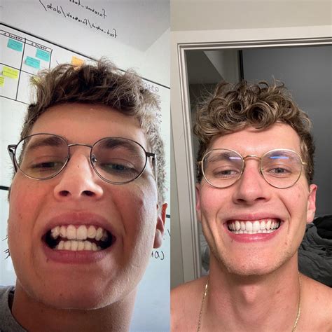 Does It Work Reddit