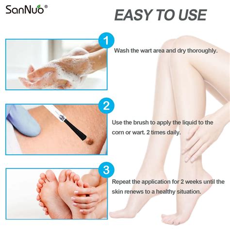 Plantar Wart Removal Stages Removal Progress Pics With SA (Plantar