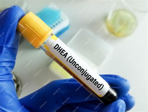 Premium Photo | Test tube with blood sample for dhea unconjugated hormone test ...
