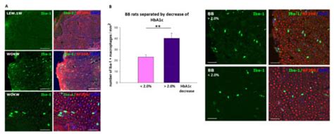 Inflammatory Mechanisms in the Pathophysiology of Diabetic Peripheral ...