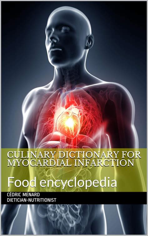 Culinary dictionary for myocardial infarction: Food encyclopedia eBook ...