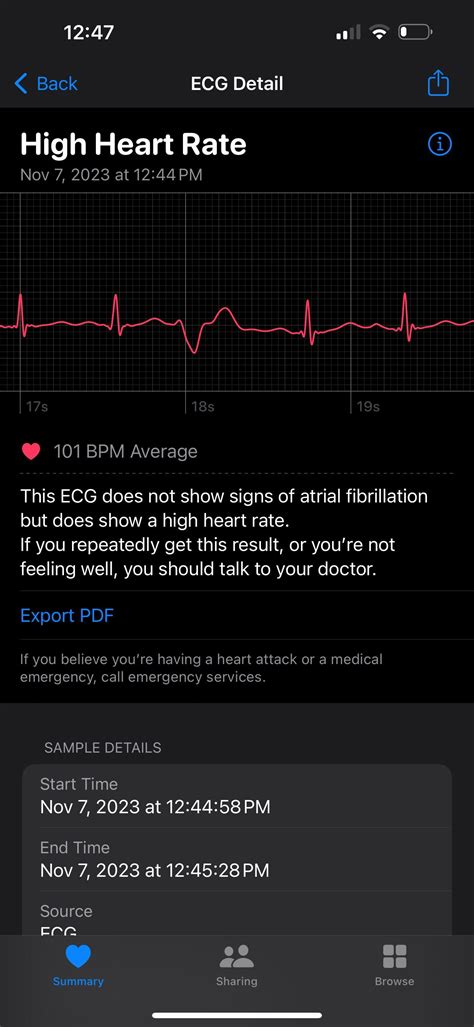 Image result for PVC ECG Reading