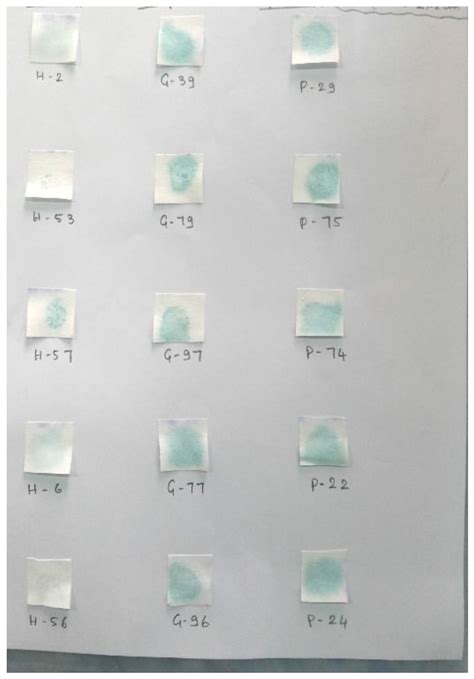 Monitoring Salivary Sialic Acid and Sialidase Activity to Assess Oral ...