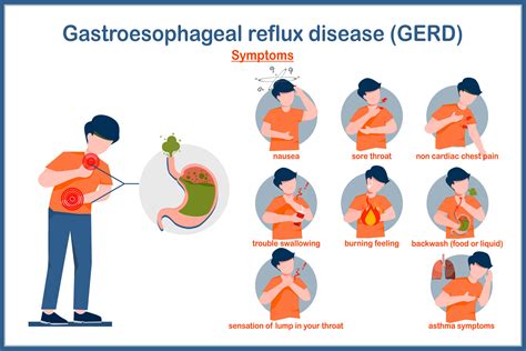 Medical vector illustration in flat style. Symptoms of Gastroesophageal reflux disease ...