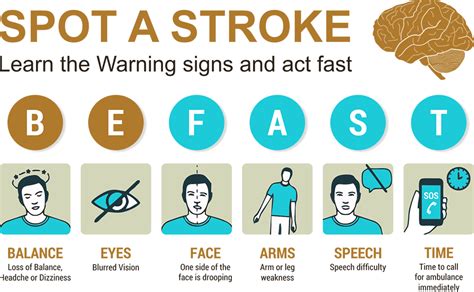 Brain Stroke - Cell Therapy