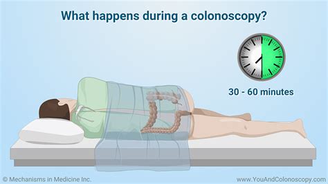 Image result for Loop Colonoscopy