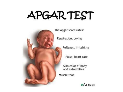 Image result for Apgar Testing