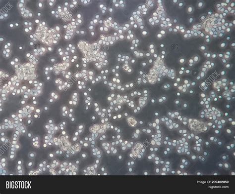 Yeast Cells Under Light Microscope