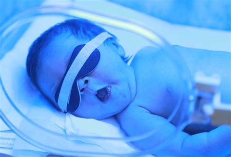 新生儿最黑暗经历，出生两天就被拉去照蓝光，足足哭了7个小时|黄疸|新生儿|蓝光_新浪新闻