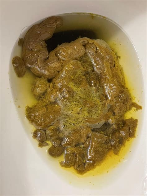 Poop #3: massive mix with a bile blast and a side of foam! : r/poop