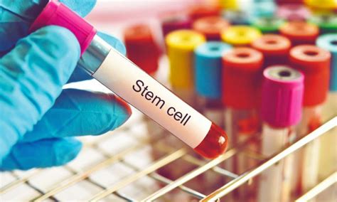Umbilical Cord Stem Cell Therapy Shows Promise in Type 2 Diabetes ...