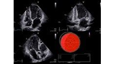 Cardiology Solutions | GE HealthCare (India)