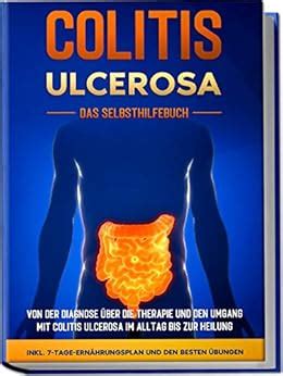 Colitis ulcerosa - Das Selbsthilfebuch: Von der Diagnose über die ...