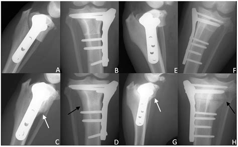 Effects of Autologous Microfragmented Adipose Tissue on Bone Healing: A ...