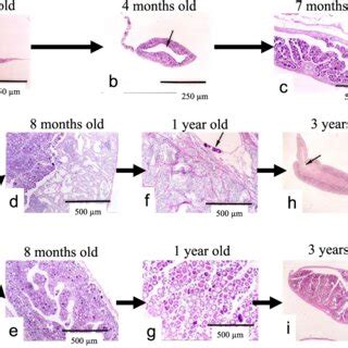 Decoding Dmrt1: Insights into vertebrate sex determination and gonadal sex differentiation