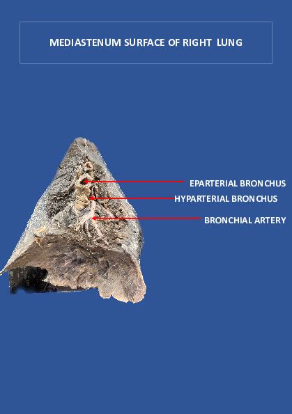 ROOT OF RIGHT LUNG | NAMO Medical Education & Research Institute