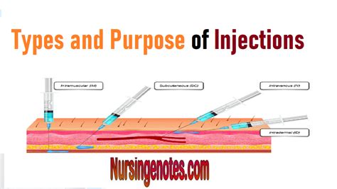 Image result for All Types of Injection