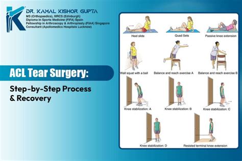ACL Tear Surgery: Step-by-Step Process & Recovery Timeline