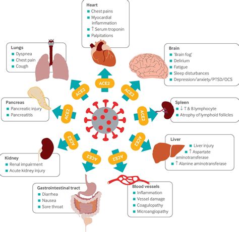 Long covid—mechanisms, risk factors, and management | The BMJ