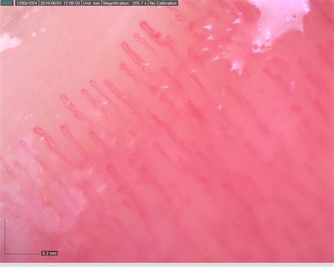 Digital Microscope