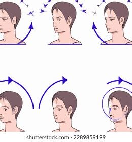 Image result for Contralateral Head Rotation